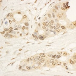 RAI1 Antibody, Novus Biologicals 0.1mg; Unlabeled:Antibodies, Polyclonal